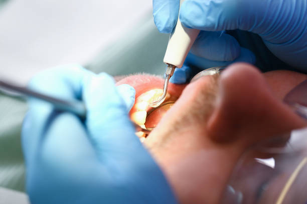 Best Emergency Care for Gum Disease in Mayfield, PA