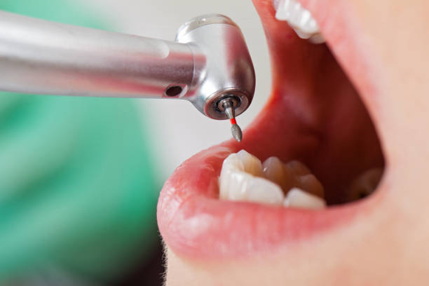 Best Emergency Dental Care for Sports Injuries in Mayfield, PA